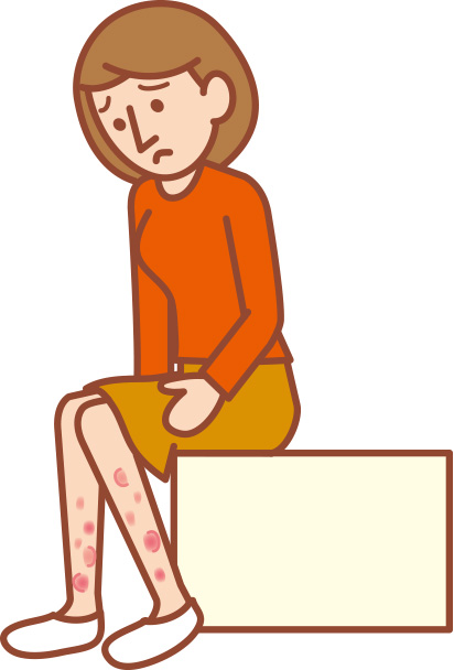 Jさんの慢性進行型神経ベーチェット病が発症したとき、足のすねあたりに赤い斑点（皮疹）ができた