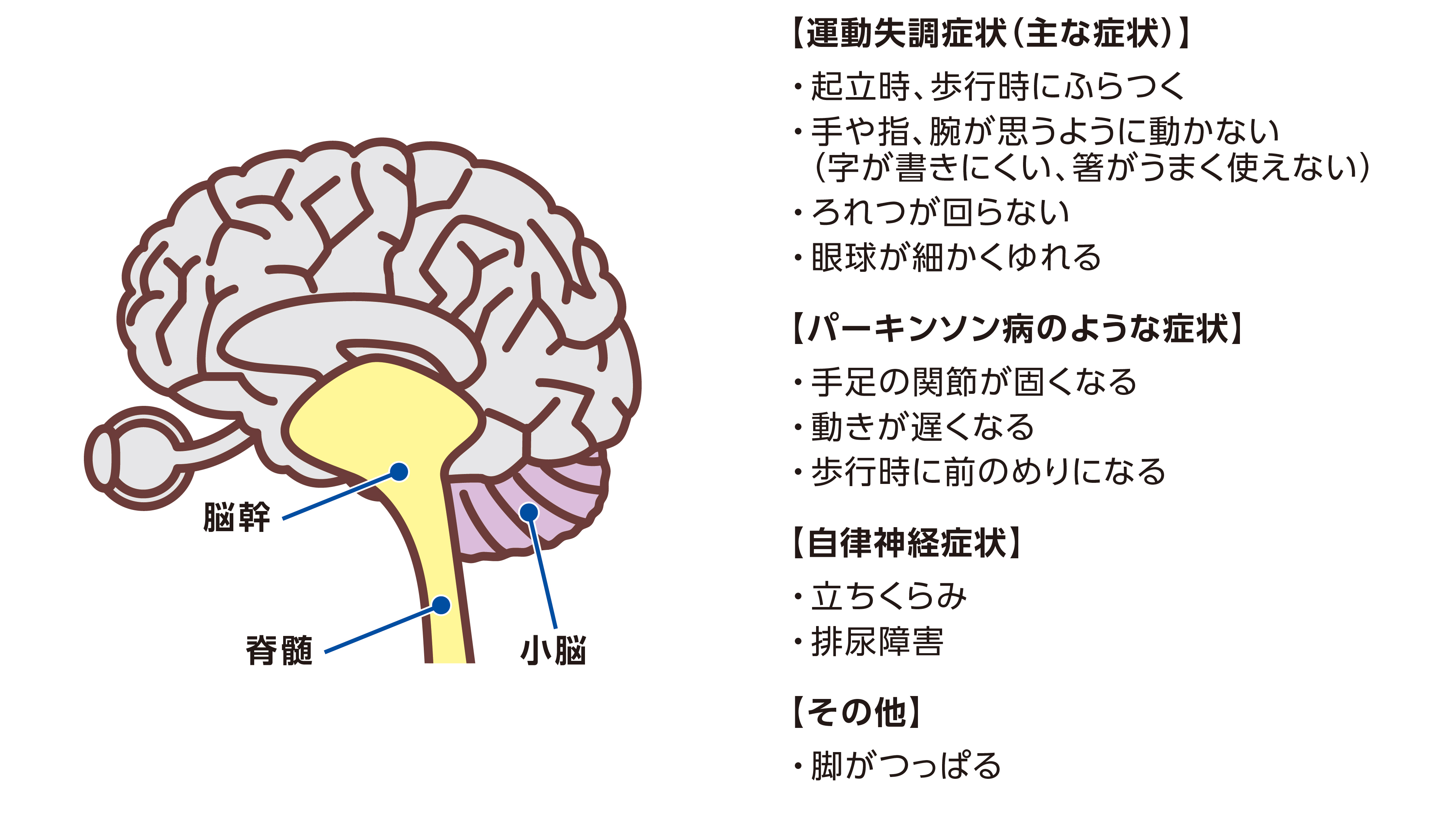 脊髄小脳変性症（SCD）にあらわれる主な症状